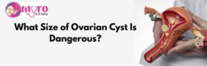 What Size of Ovarian Cyst Is Dangerous