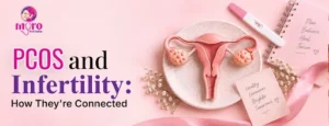 PCOS-and-Infertility-Causes-Symptoms-Treatment